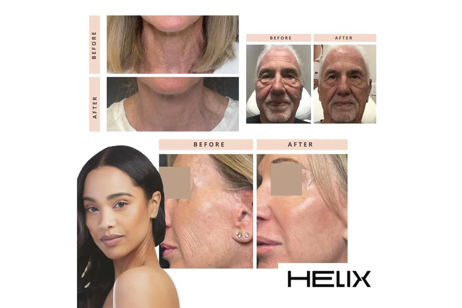 helix