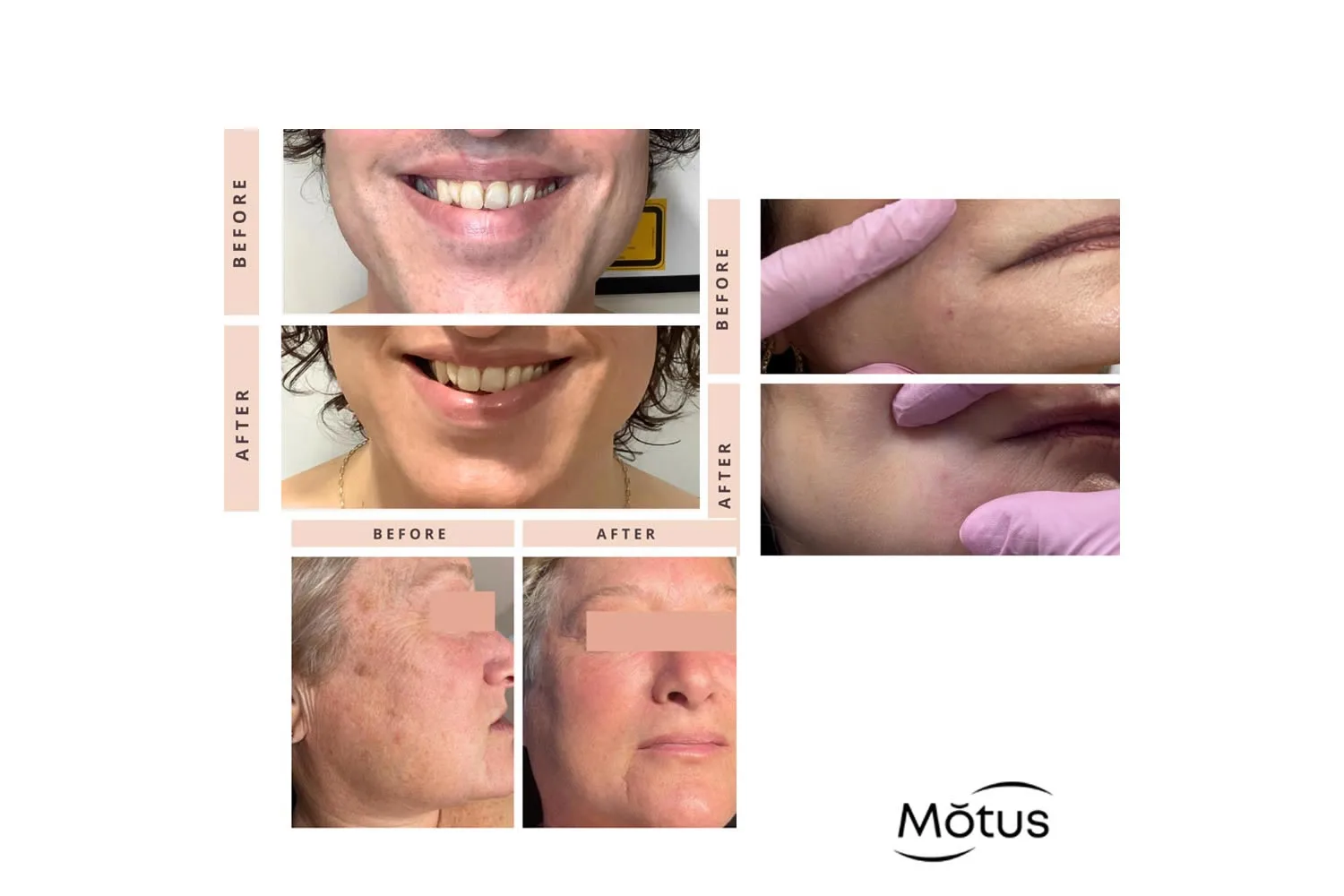 motus (2) motus